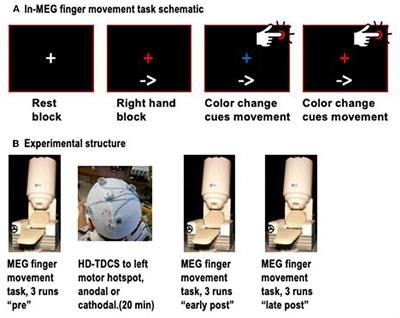 Contrasting MEG effects of anodal and cathodal high-definition TDCS on sensorimotor activity during voluntary finger movements
